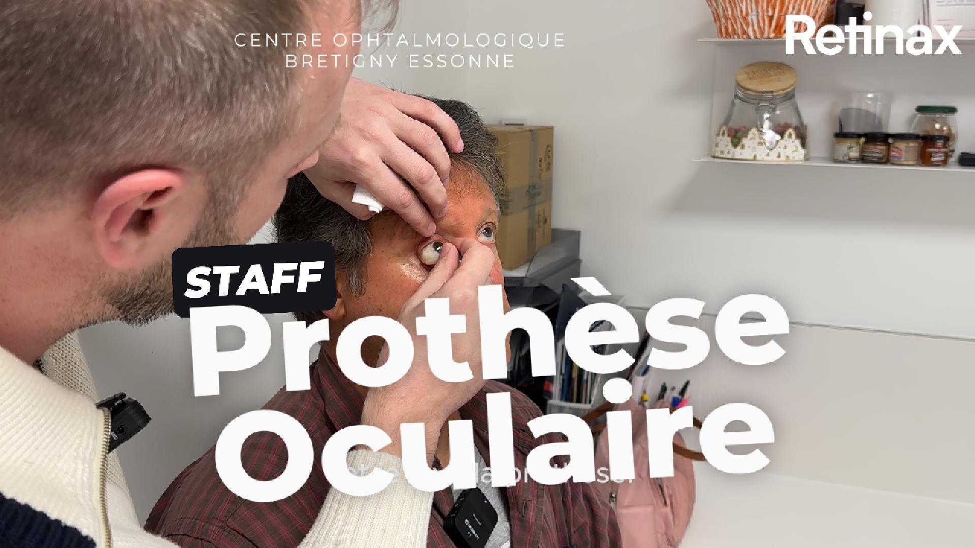 Prothèse COBESS